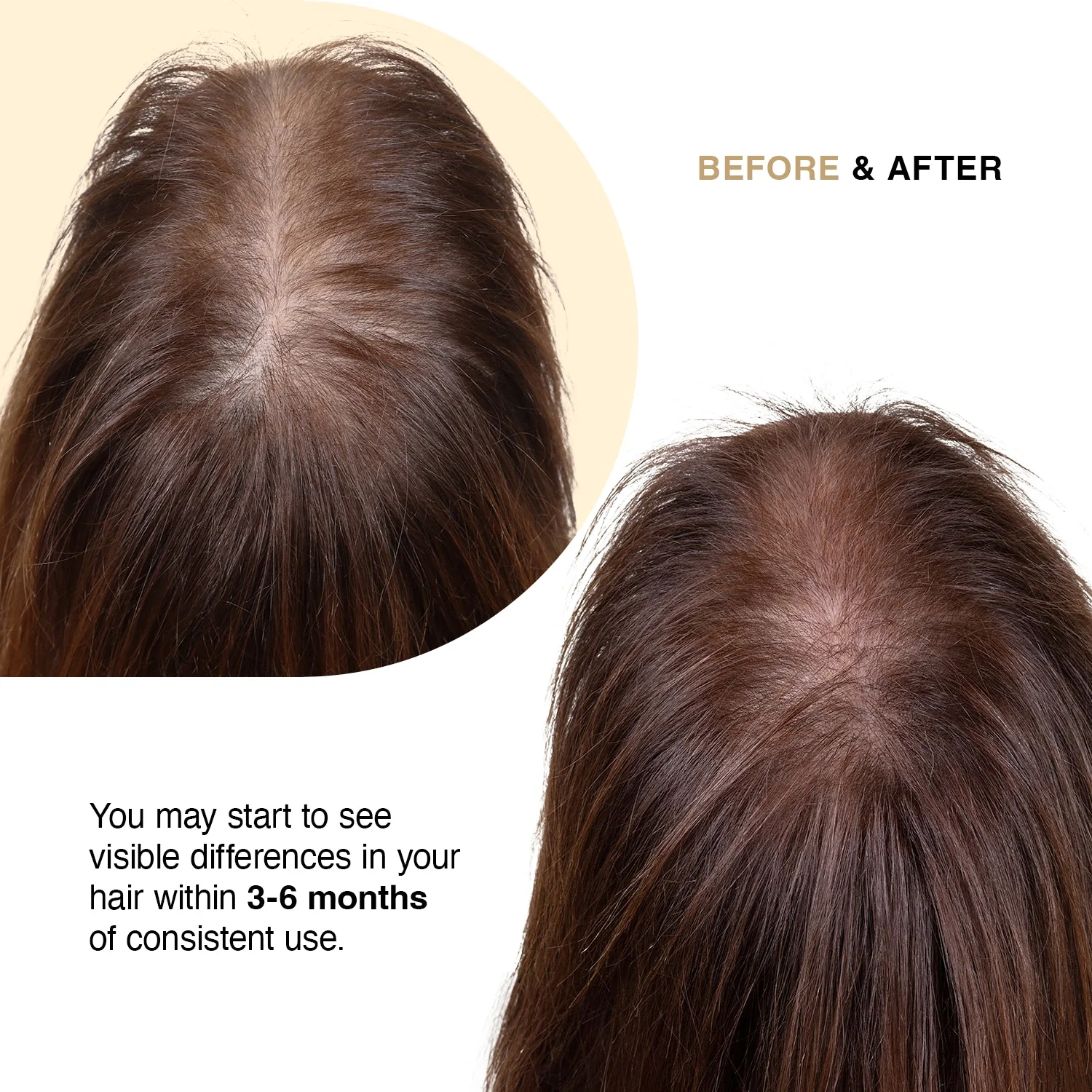 Capillus Hair Supplement - Image 7