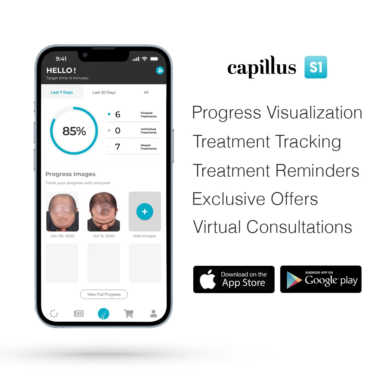 Capillus PRO S2 - Image 4